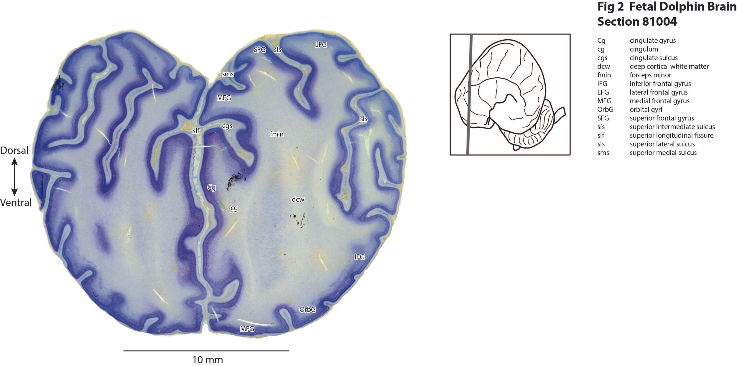 Atlas of the Brain of a Fetal Dolphin — Comparative Brain Anatomy